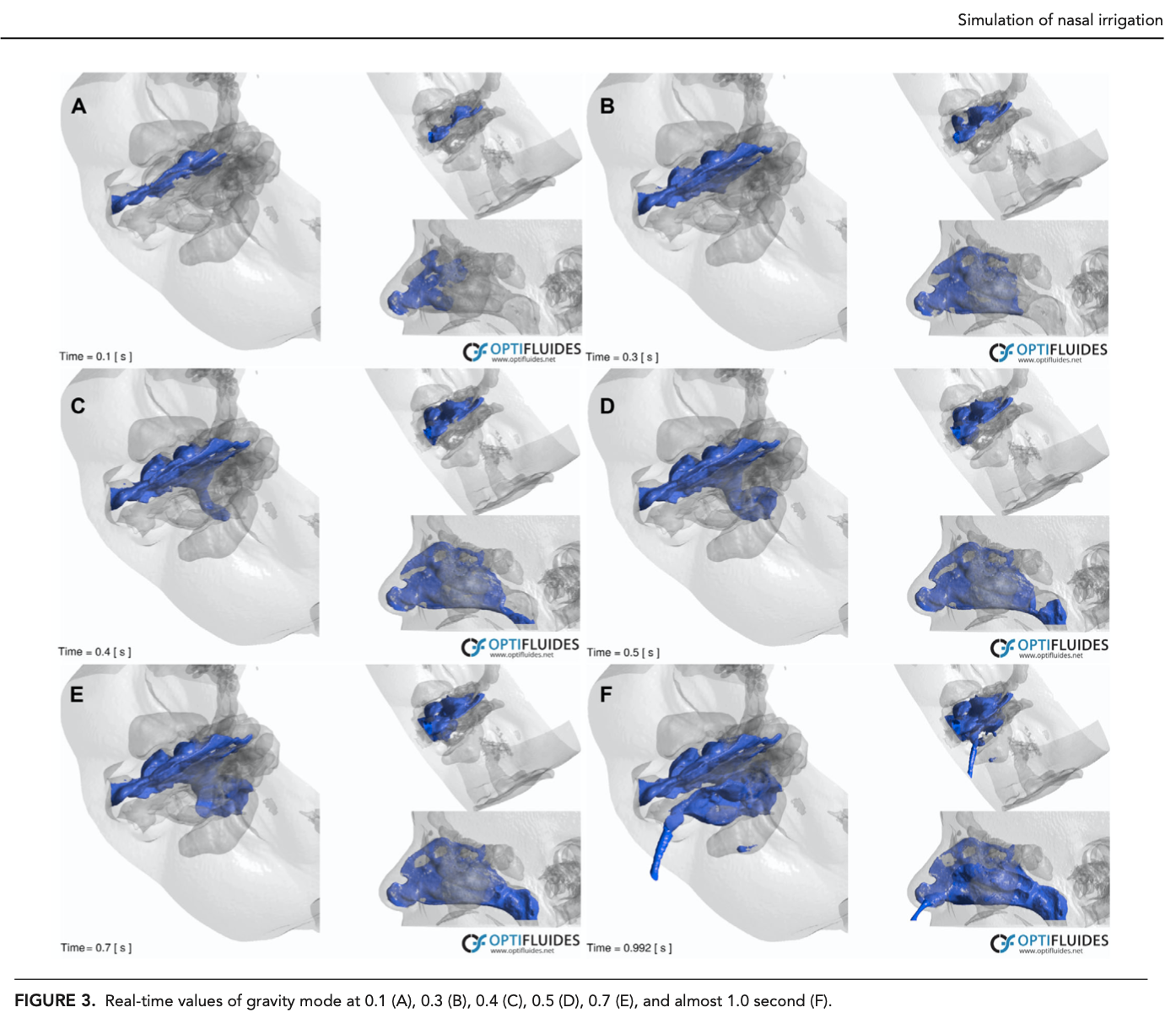 Dispositif Grand Volume